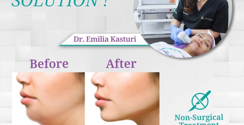 YOUR DOUBLE CHIN SOLUTION – E3A CLINIC