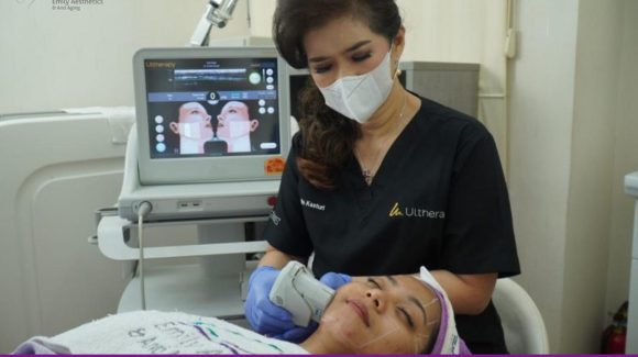 Manfaat Utama Ultherapy, Solusi Face Lifting Tanpa Operasi