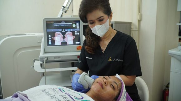 MELAWAN PENUAAN DENGAN ULTHERAPY MELAWAN PENUAAN DENGAN ULTHERAPY