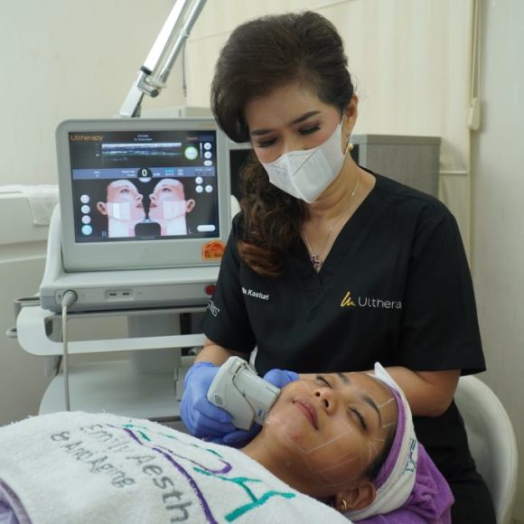 MELAWAN PENUAAN DENGAN ULTHERAPY