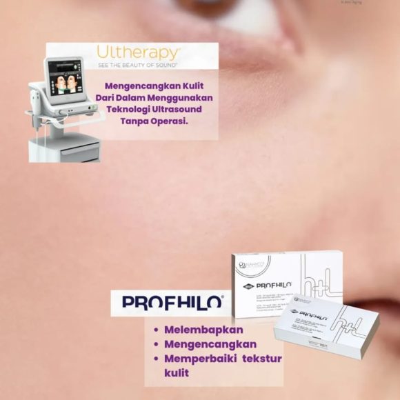 🌟 Konsultasikan kebutuhan kulitmu dengan dokter kami sekarang dan rasakan transformasi nyata untuk kulit yang lebih muda dan bercahaya!✨ Kulit sehat, kencang, dan bercahaya… Bukan lagi sekadar impian!Kini kamu bisa mendapatkan perawatan kulit komprehensif yang menggabungkan Ulthera dan Profhilo, dua teknologi terbaru untuk kulit yang lebih kencang, lembap, dan tampak awet muda.