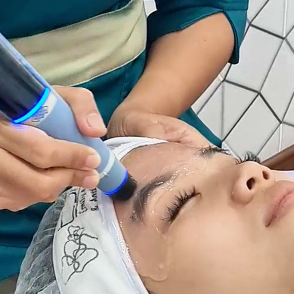 Yuk, kenalan dengan treatment kekinian yang dilengkapi dengan teknologi Artifical Intelligence (AI) Yaitu Exitight RF by EXION