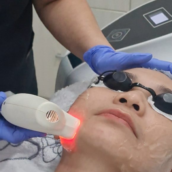 Photo Glow Radiance Treatment: Solusi Kulit Cerah, Halus, dan Bebas Noda!