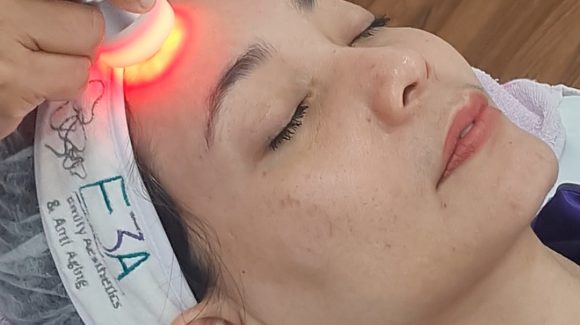 Manjakan dirimu dengan melakukan Facial Wajah di E3A Clinic ✨