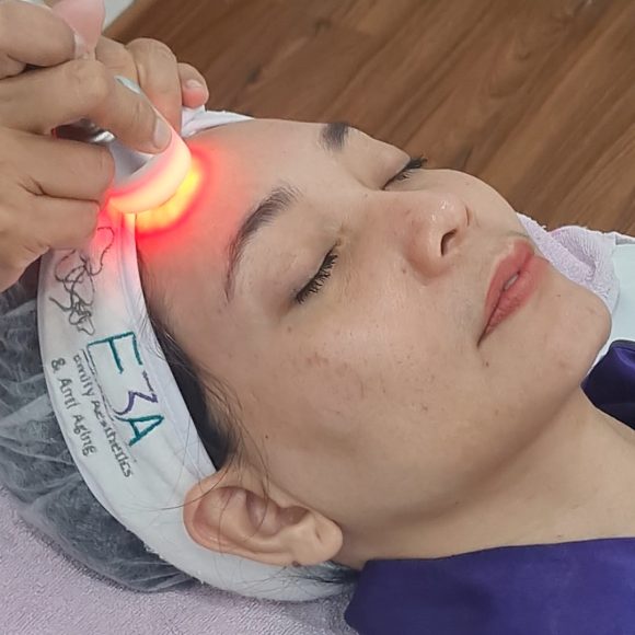 Manjakan dirimu dengan melakukan Facial Wajah di E3A Clinic ✨