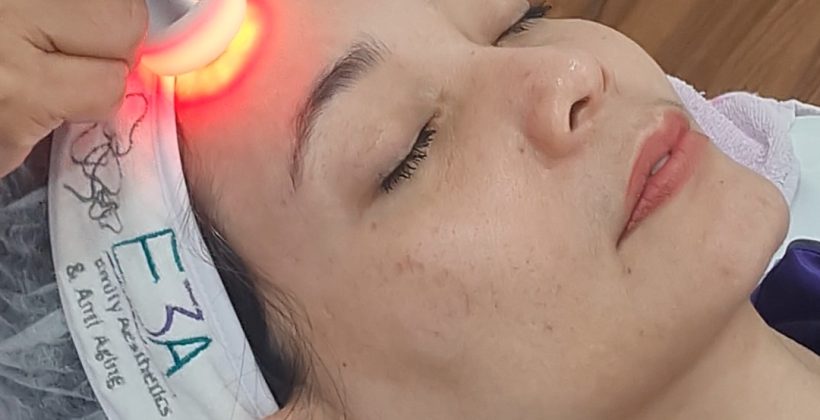 Manjakan dirimu dengan melakukan Facial Wajah di E3A Clinic ✨