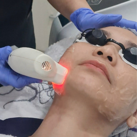 Bekas Jerawat Membandel dan Kemerahan Bikin Jengkel? Kenalan dengan Photoglow Radiance