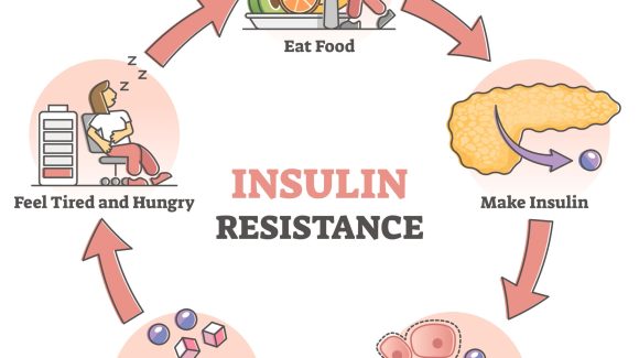 Berat badan cepat naik dan susah turun, kulit wajah rentan berjerawat, serta mudah lelah, bisa jadi insulin resisten pada tubuhmu sedang terganggu! Berat badan cepat naik dan susah turun, kulit wajah rentan berjerawat, serta mudah lelah, bisa jadi insulin resisten pada tubuhmu sedang terganggu!