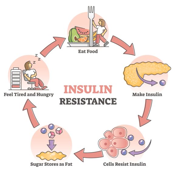 Berat badan cepat naik dan susah turun, kulit wajah rentan berjerawat, serta mudah lelah, bisa jadi insulin resisten pada tubuhmu sedang terganggu!
