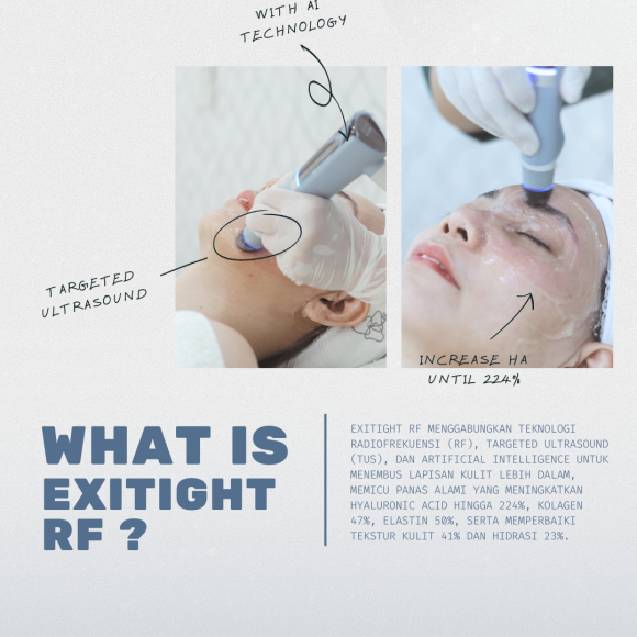 Wujudkan Wajah Kencang dan Kontur Tegas dengan ExiTide RF by Exion, Hanya di Klinik E3A!
