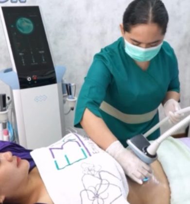 Kencangkan Tubuh dan Hancurkan Lemak Sekaligus: Exitight Body by Exion, Eksklusif di Klinik E3A Kencangkan Tubuh dan Hancurkan Lemak Sekaligus: Exitight Body by Exion, Eksklusif di Klinik E3A