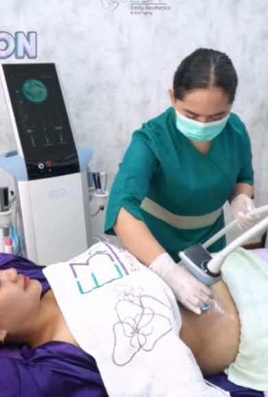 Kencangkan Tubuh dan Hancurkan Lemak Sekaligus: Exitight Body by Exion, Eksklusif di Klinik E3A