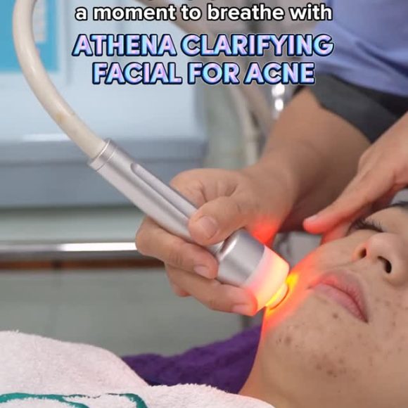 Rahasia Kulit Sehat “Glass Skin” Korea: Oxygen Facial di E3A Klinik