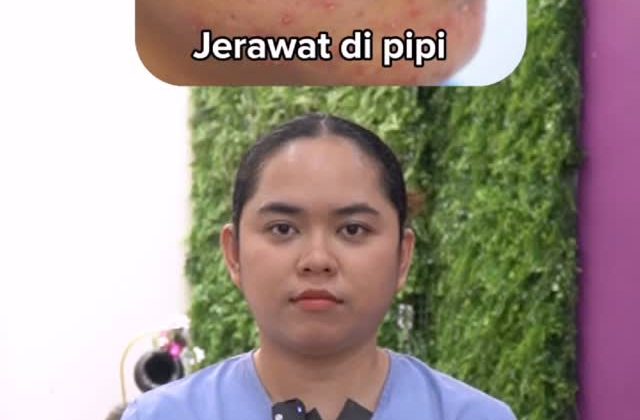 Apa Pesan di Balik Jerawatmu? Yuk, Kenali Tandanya! 🔍✨