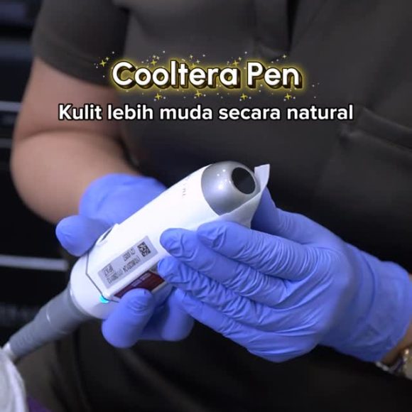 Mengenal Cool Pen Treatment: Solusi Tirus dan Kencang Tanpa Rasa Sakit hingga ke Sudut Wajah