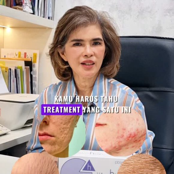 Bopeng membandel & kulit kendur bikin kurang percaya diri? Saatnya perbaiki dari akarnya! ✨